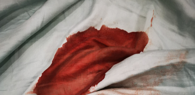 How to remove blood stains from your clothes